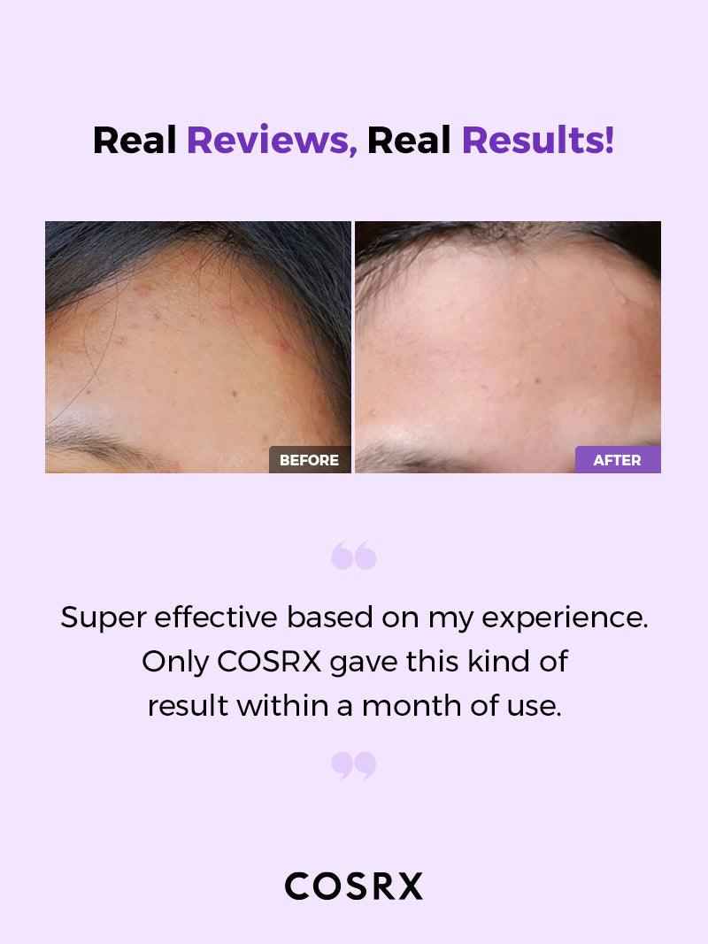 [COSRX] AHA/BHA Clarifying Treatment Toner